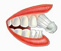 Zahnarzt Basel erklärt das Zähneputzen